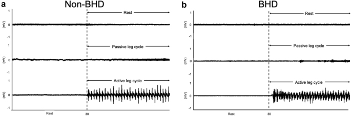 holding breath heart rate experiment figure 2