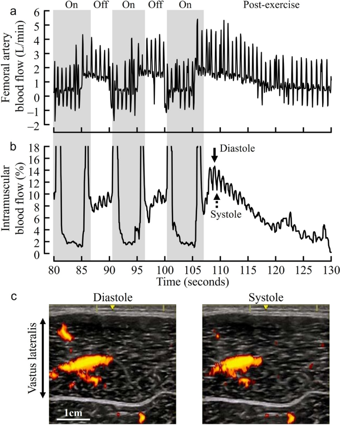 Simultaneous assessment of blood flow changes in femoral artery and ...