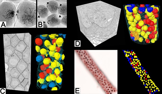 The invisible cytomixis: how a cytological phenomenon can be ...