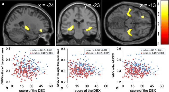 Brain Structures Associated With Executive Functions During Everyday Events In A Non Clinical Sample Springerlink Brain Structures Associated With Executive Functions During Everyday Events In A Non Clinical Sample Springerlink