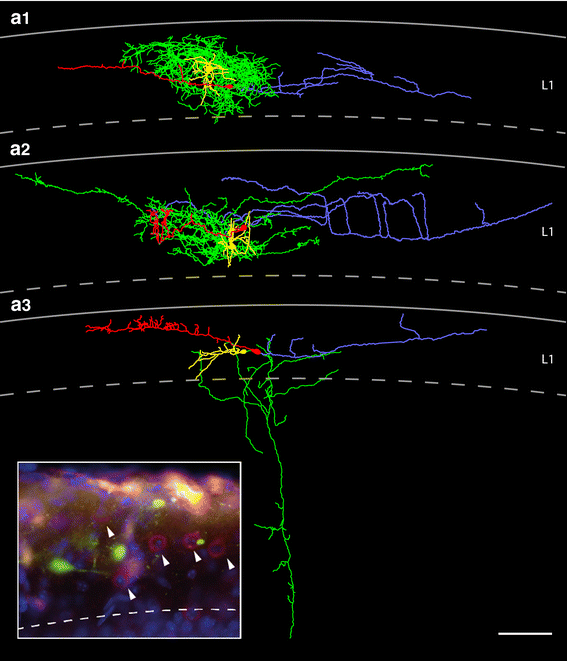 figure 11