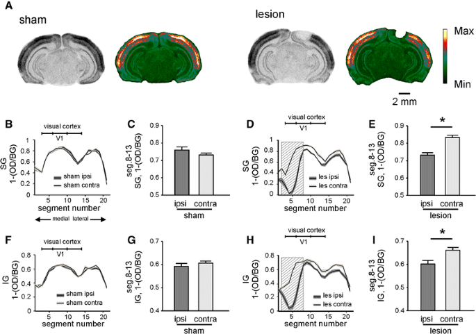Neuronal mechanisms underlying transhemispheric diaschisis following focal  cortical injuries | SpringerLink