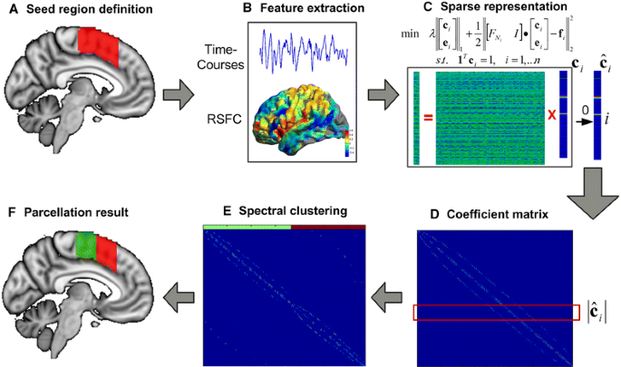 Robust Brain Parcellation Using Sparse Representation On Resting State Fmri Springerlink