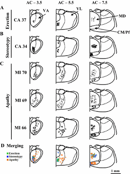 An Update On The Phenotype Genotype And Neurobiology Of Adcy5 Related Disease Ferrini 2021 Movement Disorders Wiley Online Library