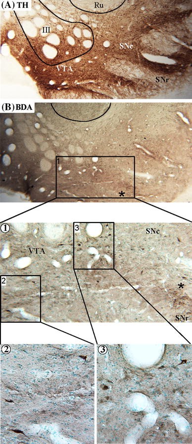 Cortico Basal Ganglia Circuits Involved In Different Motivation Disorders In Non Human Primates Springerlink