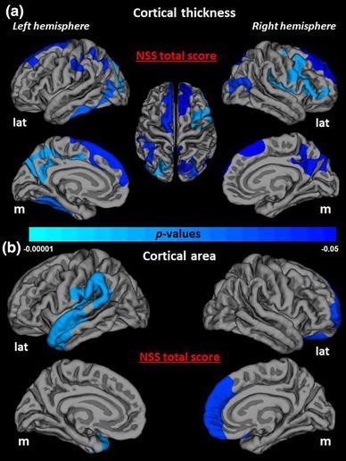 Multiparametric mapping of neurological soft signs in healthy adults |  SpringerLink