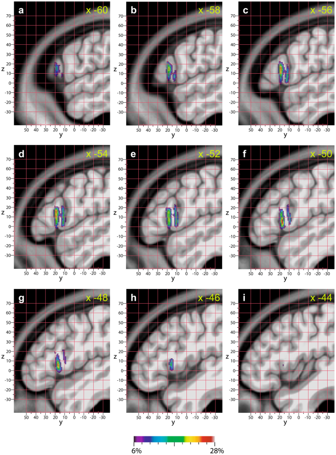 figure 16