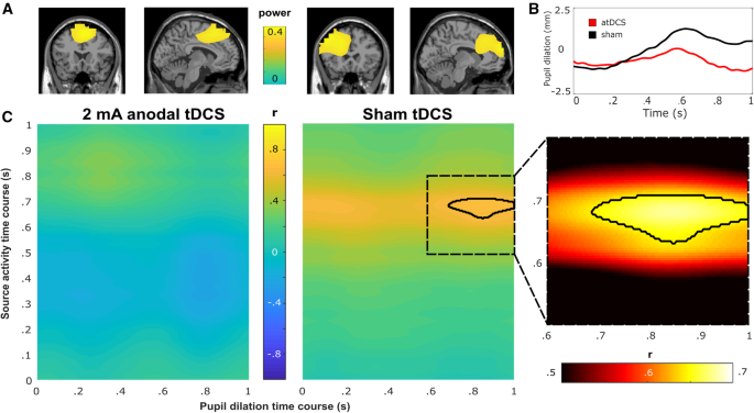 Anodal tDCS affects neuromodulatory effects of the norepinephrine ...