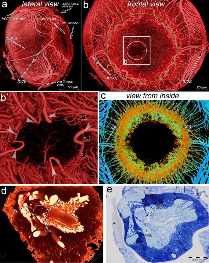 High-resolution micro-CT for 3D infarct characterization and segmentation  in mice stroke models