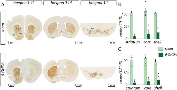 The Density Of Calretinin Striatal Interneurons Is Decreased In 6 Ohda Lesioned Mice Springerlink