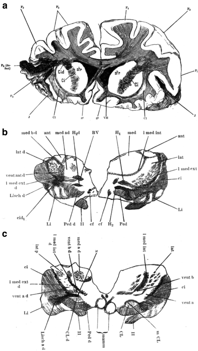 The Thalamus - Draw it to Know it - Neuroanatomy Tutorial 