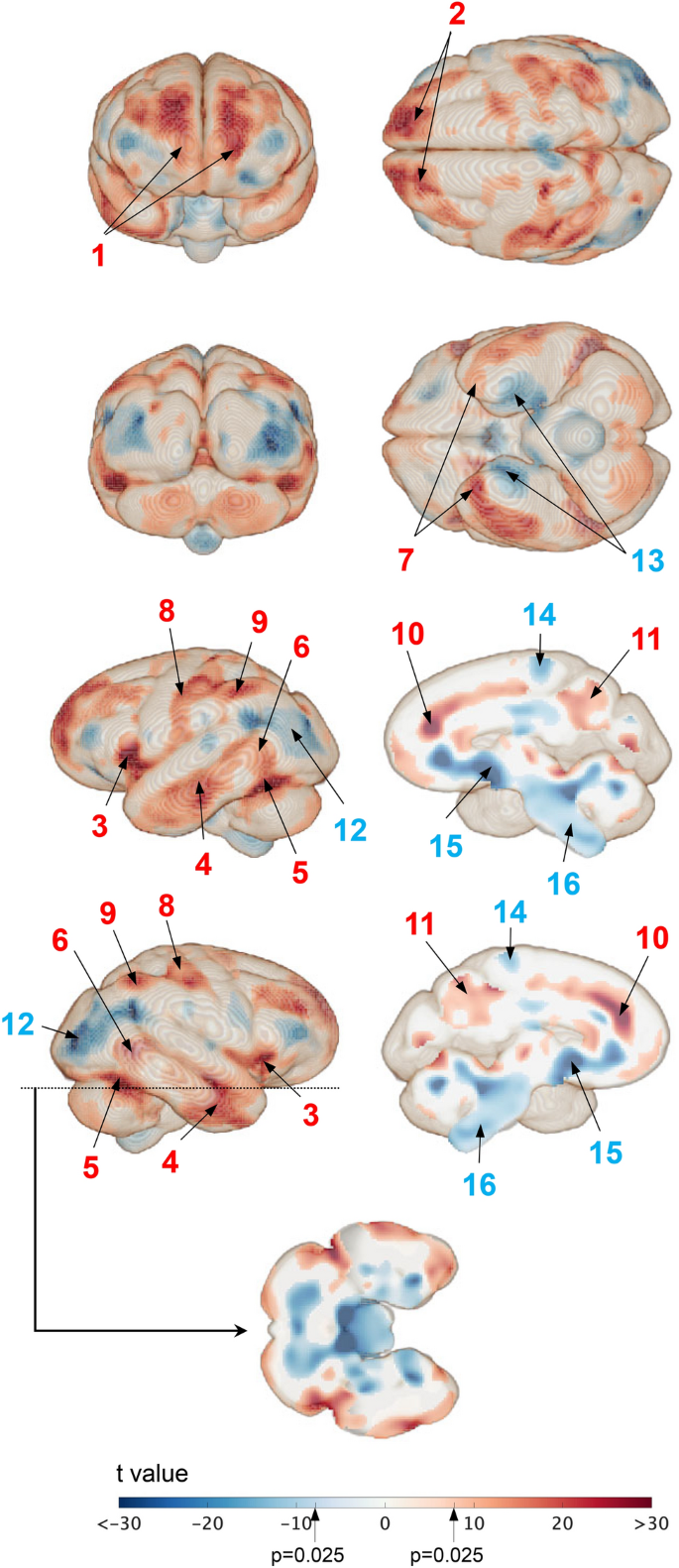 Enlargement of the human prefrontal cortex and brain mentalizing ...