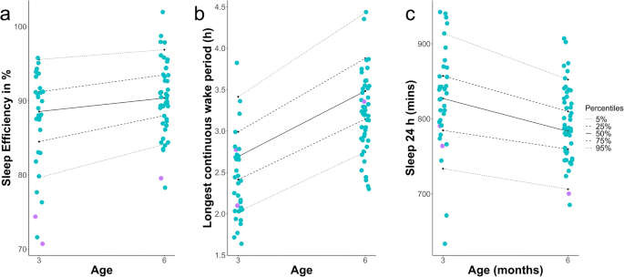 Sleep behavior of infants with infantile hemangioma treated with propranolol—a  cohort study | SpringerLink