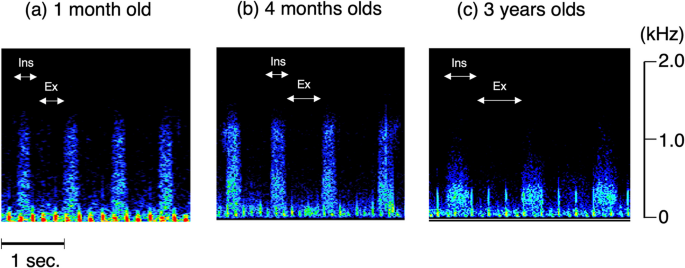 Characteristics of lung sounds in early infants using automated ...
