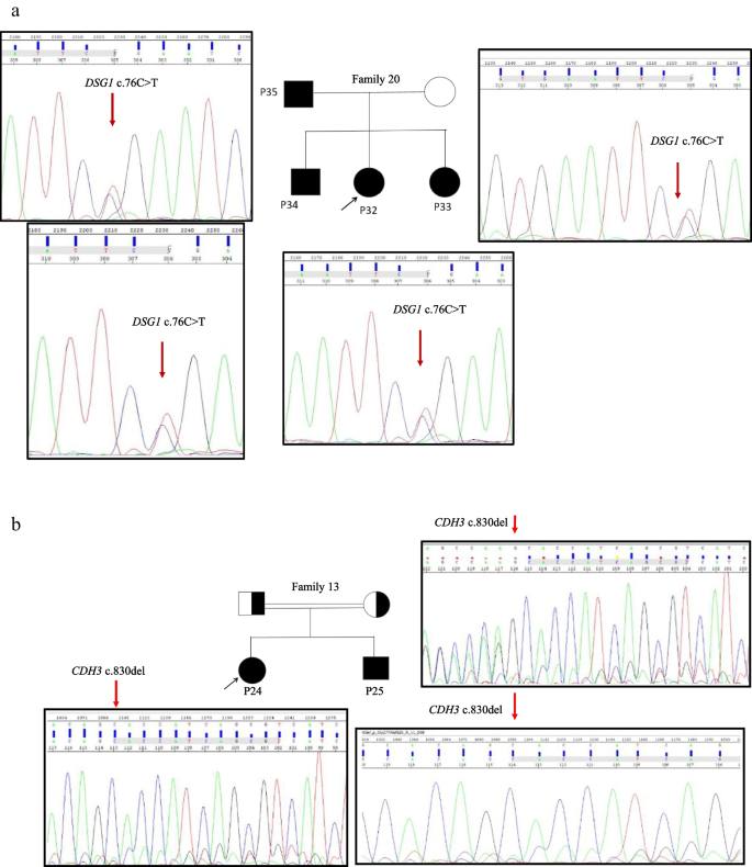 Ectodermal dysplasias and isolated ectodermal anomalies: expanding the ...