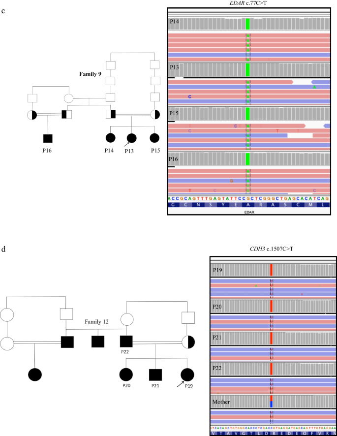 Ectodermal dysplasias and isolated ectodermal anomalies: expanding the ...