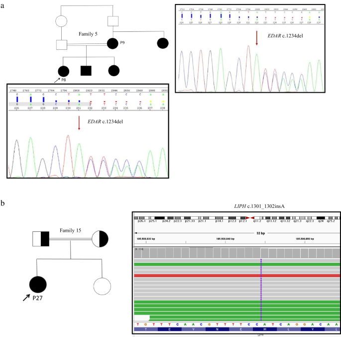 Ectodermal dysplasias and isolated ectodermal anomalies: expanding the ...