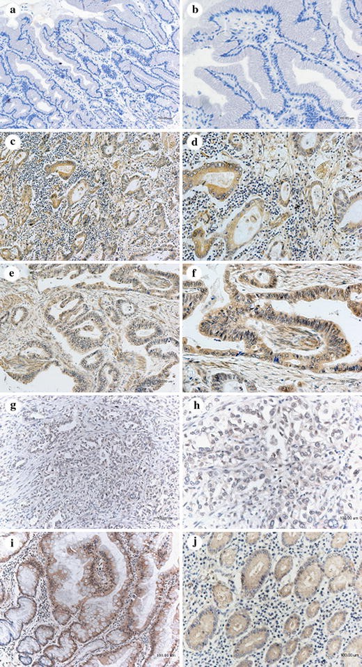 Over-expression of FRZB in gastric cancer cell suppresses proliferation and  induces differentiation | SpringerLink