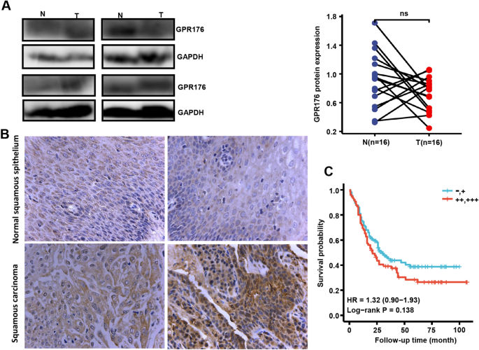 Identification and functional characterisation of N-linked glycosylation of  the orphan G protein-coupled receptor Gpr176