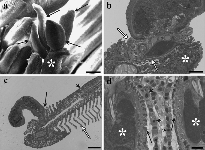 Gill Histopathology Of Cultured European Sea Bass Dicentrarchus Labrax L Infected With Diplectanum Aequans Wagener 1857 Diesing 1958 Diplectanidae Monogenea Springerlink