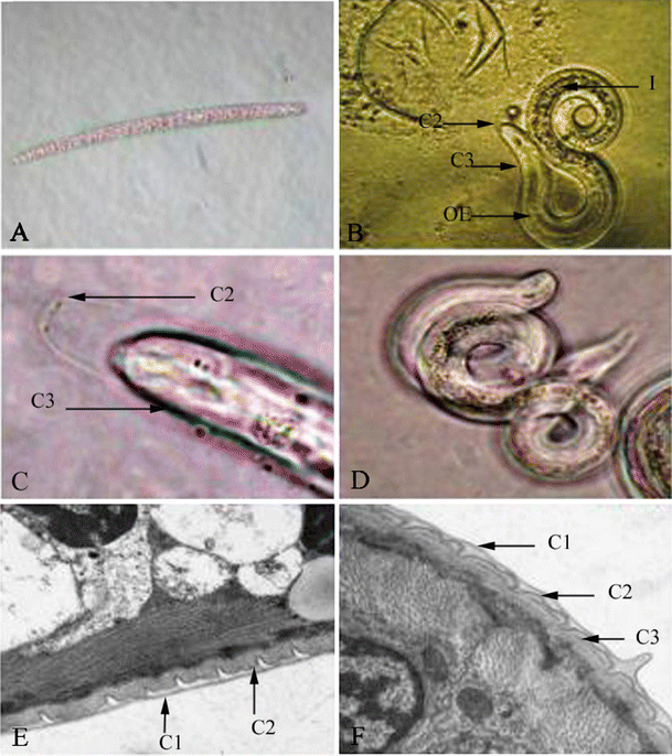 ascariasis lárva stádiuma