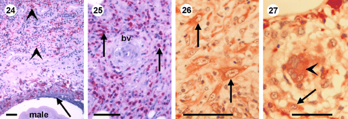 figure 24-27