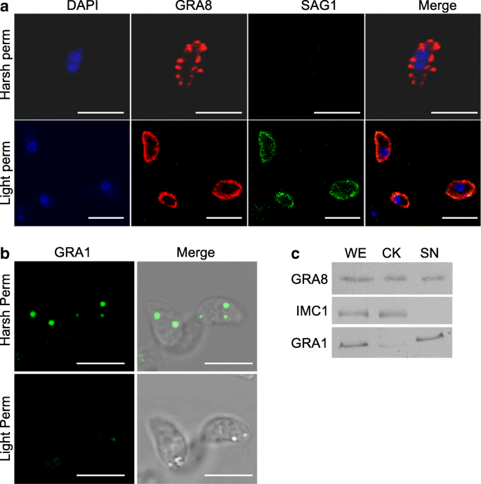 The dense granule protein 8 (GRA8) is a component of the sub-pellicular  cytoskeleton in Toxoplasma gondii | SpringerLink