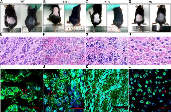 Role of thymosin beta 4 in hair growth | Molecular Genetics and Genomics |  Springer Nature Link