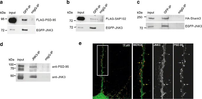 Characterisation Of De Novo Mapk10 Jnk3 Truncation Mutations Associated With Cognitive Disorders In Two Unrelated Patients Springerlink