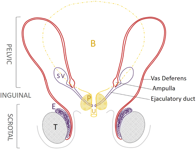 Genetics of the congenital absence of the vas deferens | SpringerLink