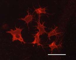 Isolated primary osteocytes express functional gap junctions in vitro |  SpringerLink