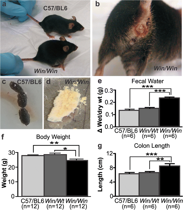 Alterations In The Distal Colon Innervation In Winnie Mouse Model Of Spontaneous Chronic Colitis Springerlink