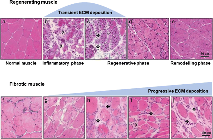 Skeletal Muscle Fibrosis An Overview Springerlink