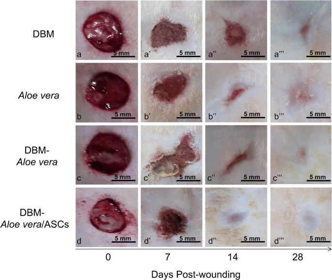 Healing potential of injectable Aloe vera hydrogel loaded by  adipose-derived stem cell in skin tissue-engineering in a rat burn wound  model | Cell and Tissue Research | Springer Nature Link