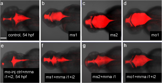 Camel Regulates Development Of The Brain Ventricular System Springerlink