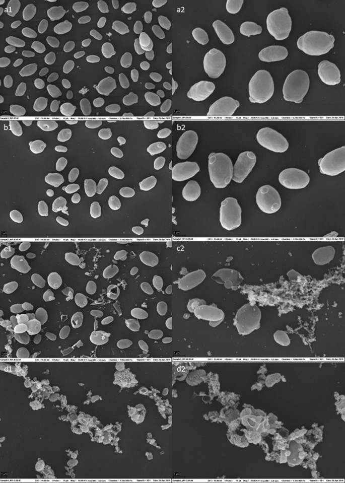 Spruce Sugars And Poultry Hydrolysate As Growth Medium In Repeated Fed Batch Fermentation Processes For Production Of Yeast Biomass Springerlink