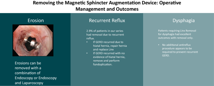 Removing the magnetic sphincter augmentation device: operative management  and outcomes | SpringerLink