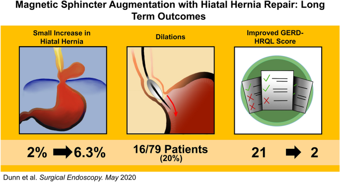 Magnetic sphincter augmentation with hiatal hernia repair: long term  outcomes | SpringerLink