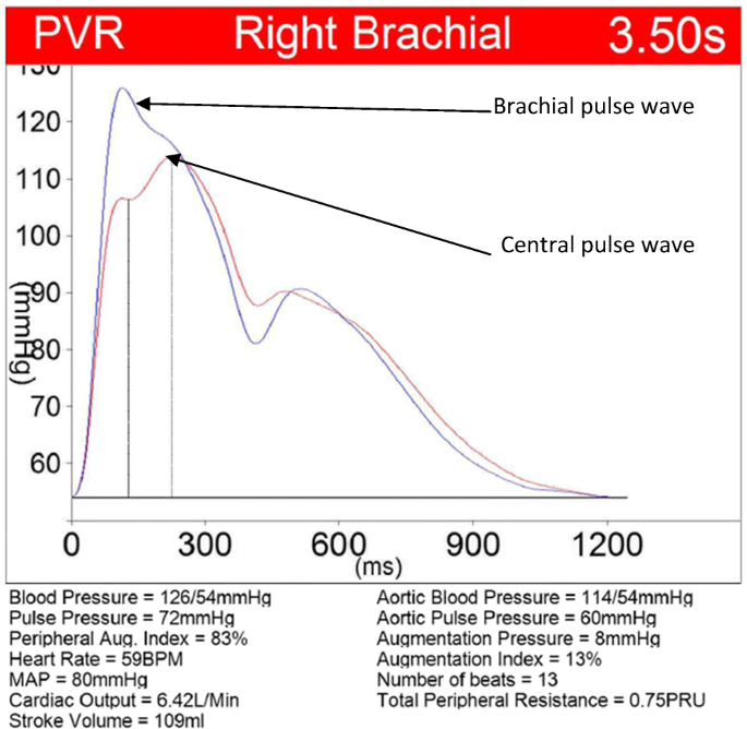 blood pressure pulse