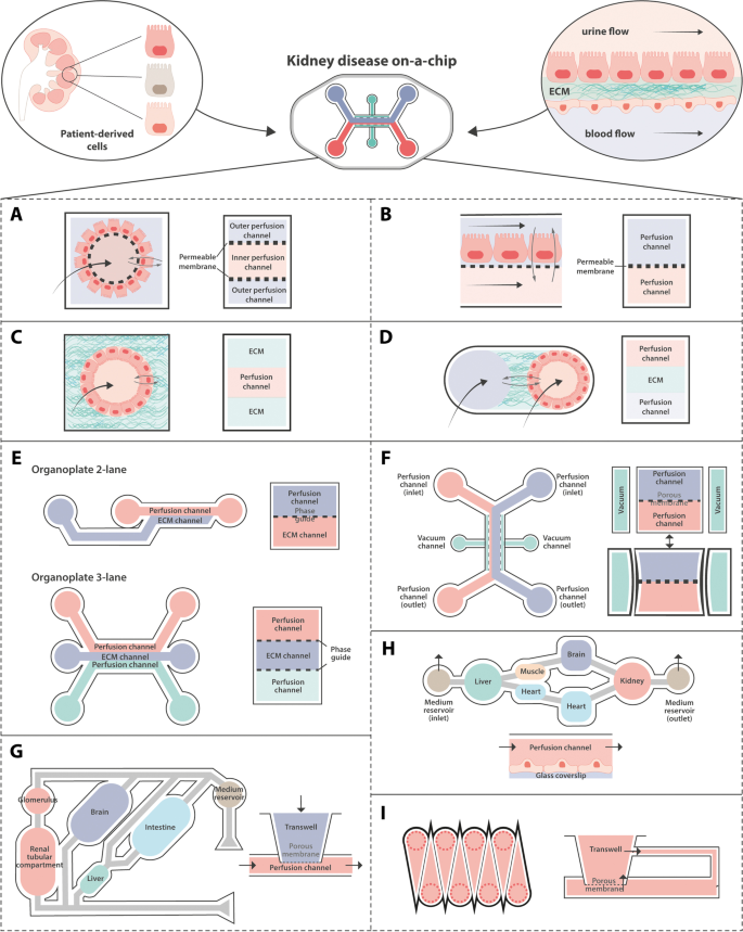 Organs-on-chip technology: a tool to tackle genetic kidney 