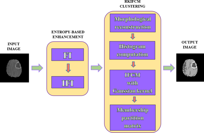 A novel enhancement-based rapid kernel-induced intuitionistic 