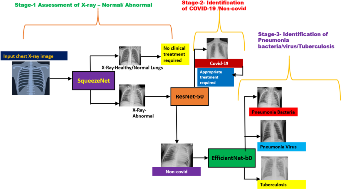 Detection of COVID-19 & non-COVID diseases from chest-X-rays using deep ...