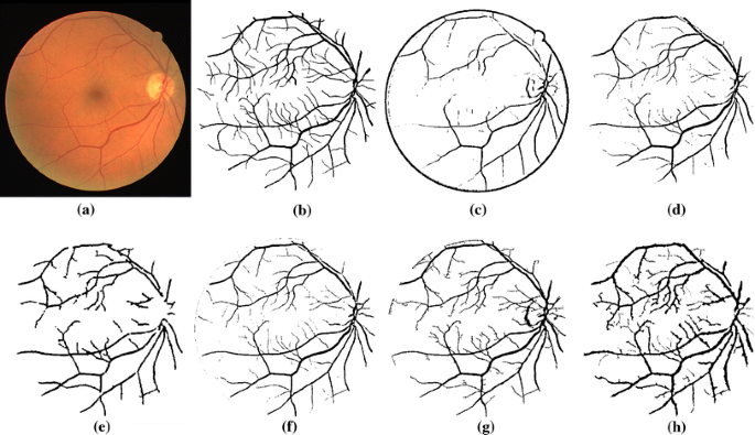 figure 11