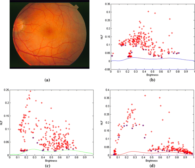 figure 31