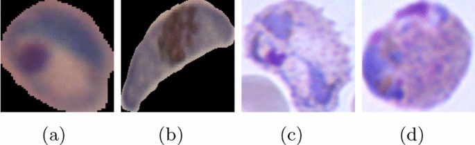 literature review on malaria prevention figure 2