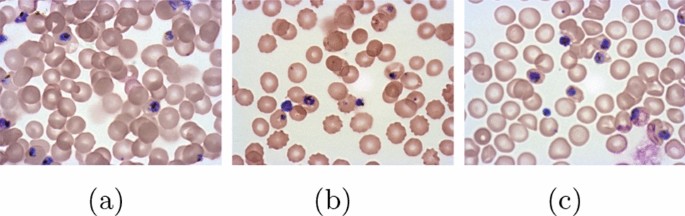 literature review on malaria prevention figure 4