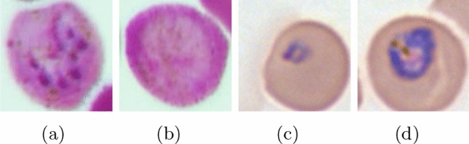 literature review on malaria prevention figure 5
