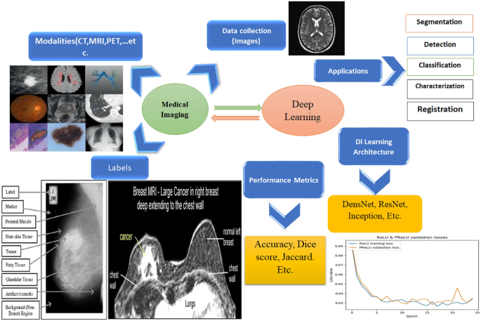Deep Learning in Medical Imaging