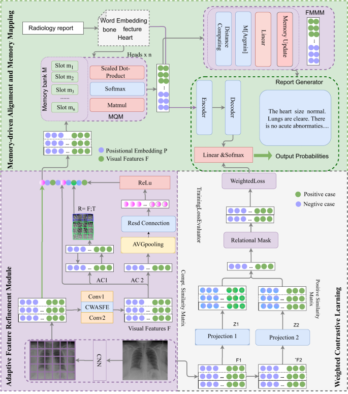 Mwcl: Memory-driven and mapping alignment with weighted contrastive ...