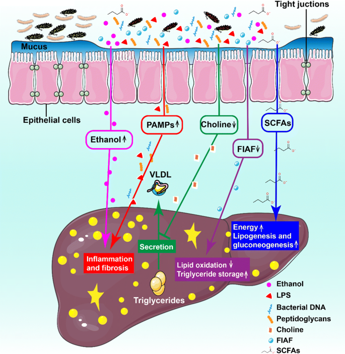 Otthoni méregtelenítés - Dysbiosis nafld